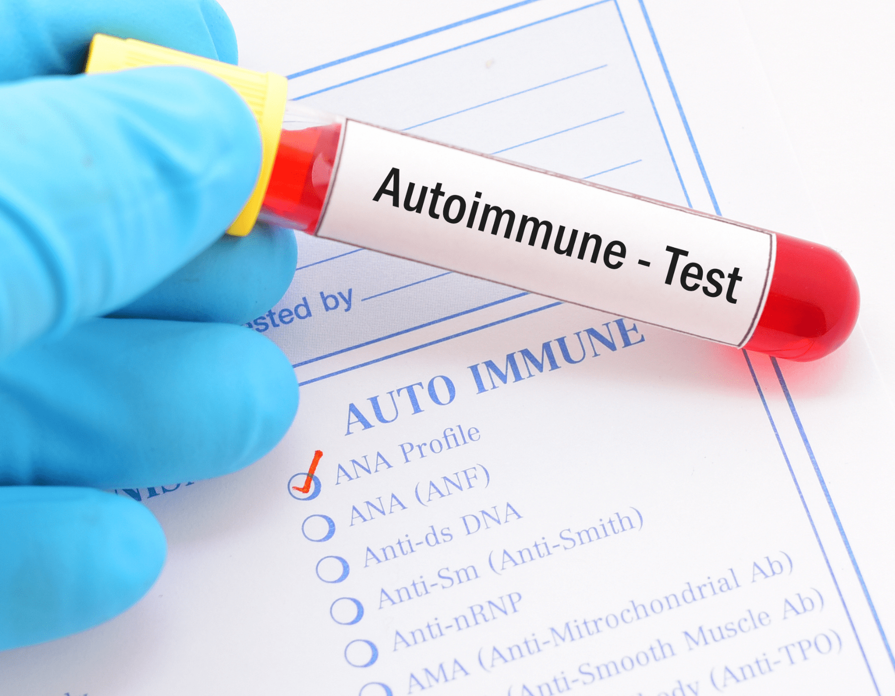 Autoimmune test pic for website