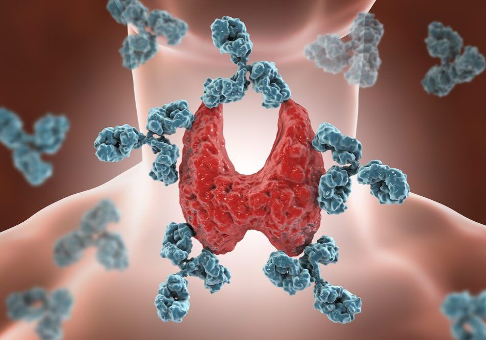 Autoimmune Thyroiditis Hashimoto's Disease. 3d Illustration Showing Antibodies Attacking Thyroid