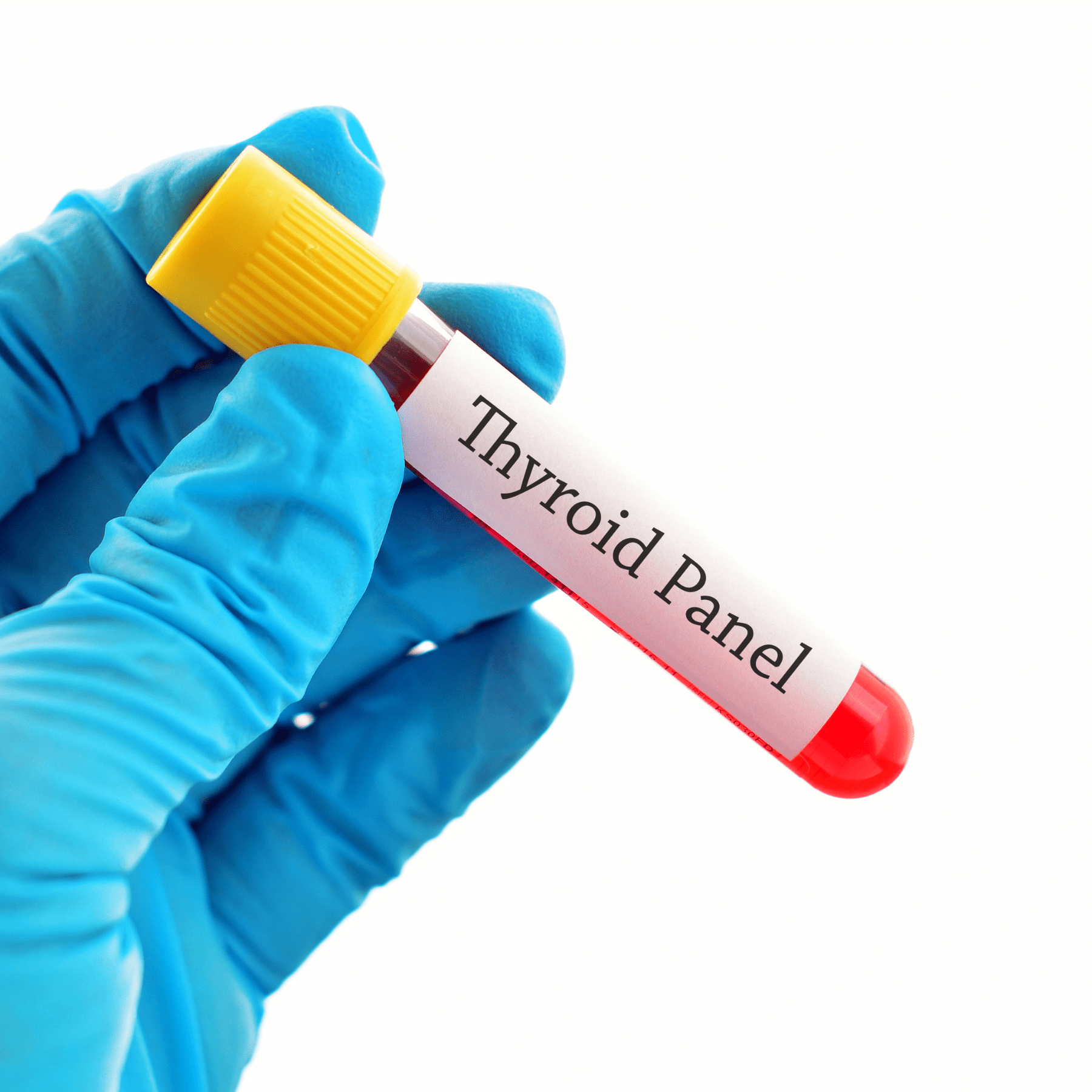 Thyroid test pic